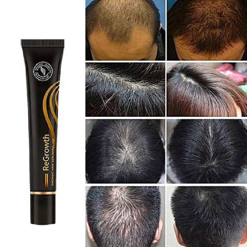 Regrowt Hair - Compre 1 leve 2 | Óleo de Crescimento Capilar - Diminui Queda 95% e Aumenta Crescimento